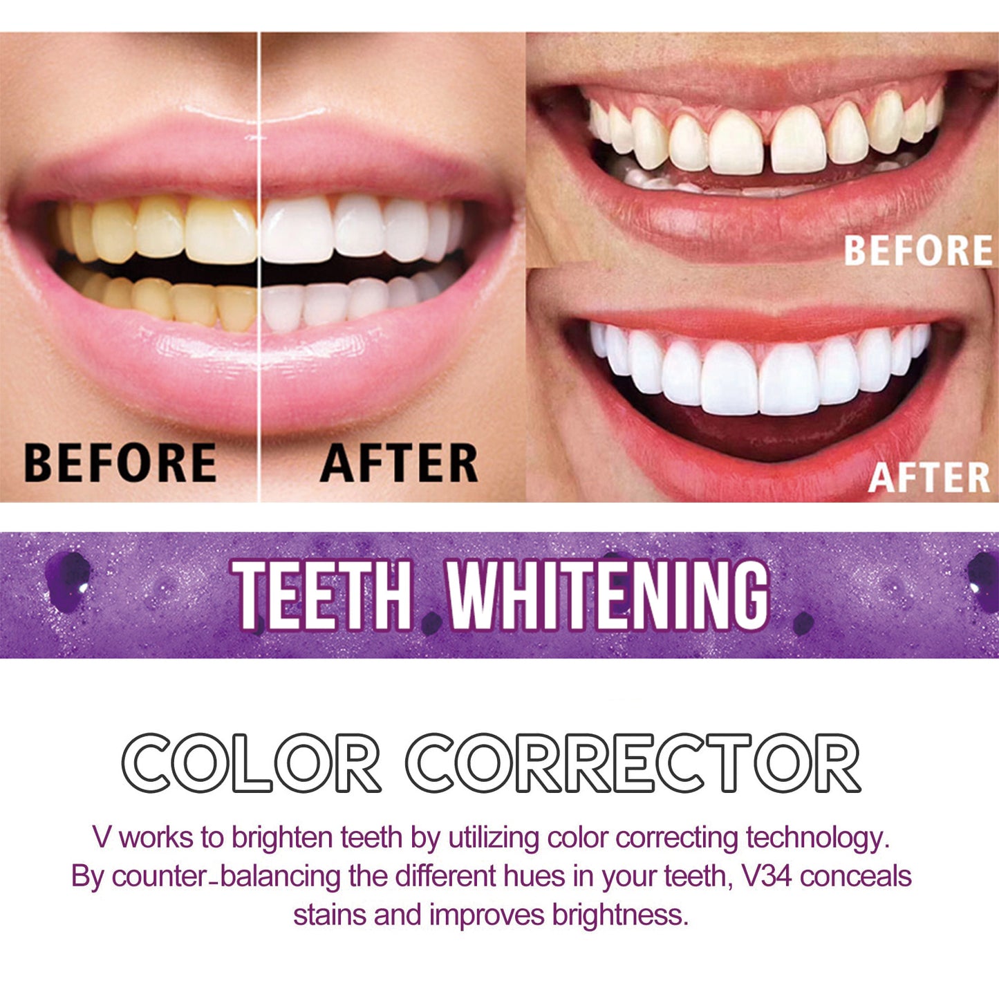 Whiteteeth™