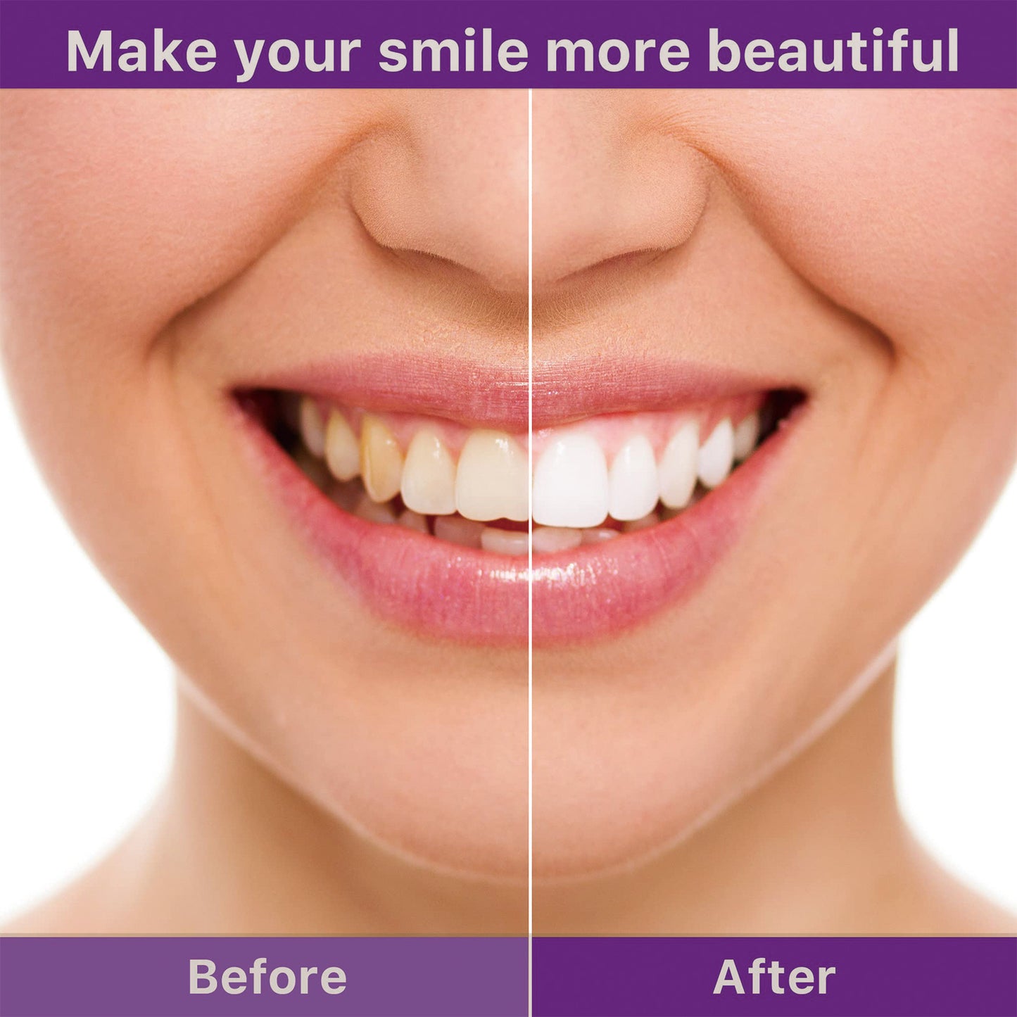 Whiteteeth™
