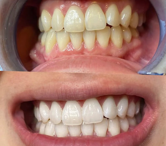 Dentifrice Miswak Original XXL