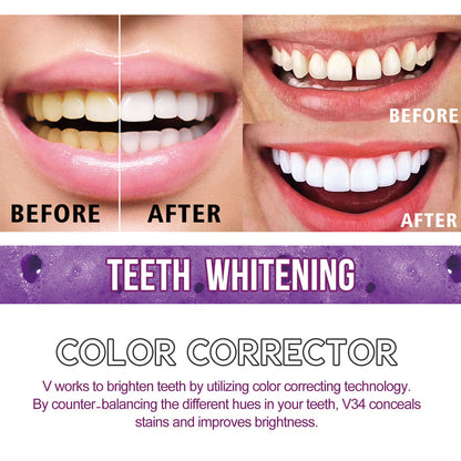 Whiteteeth™